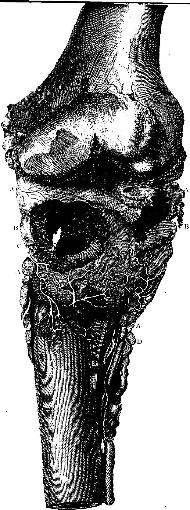 Eine Schwarz-Weiß-Zeichnung eines menschlichen Knies mit einem Bruch in der Mitte und einem Text unten, der "Anatomie des Kniegelenks" lautet.
